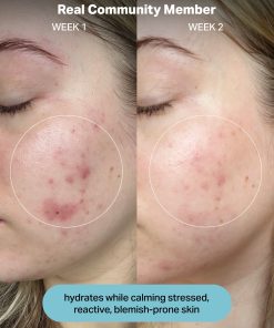 Hydrating Electrolyte Rescue Serum