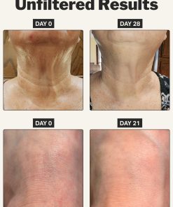 retinol body cream
