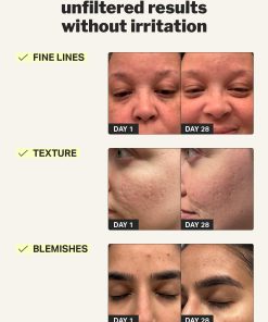 beginner retinol gel 0.1%