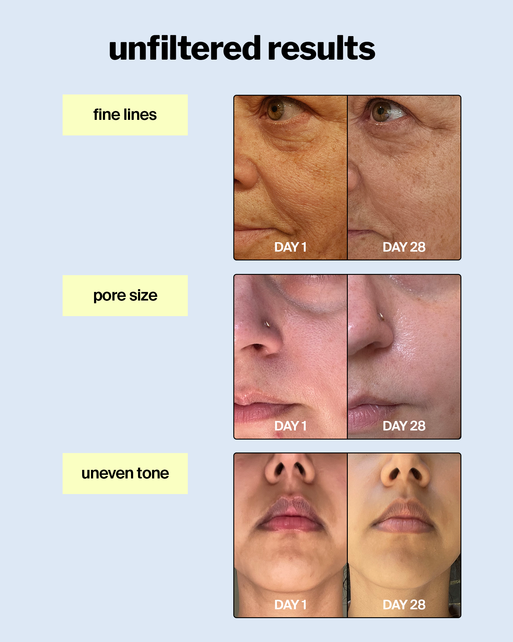 sm-image-a594ce14ebf6012c3c1fdddb advanced retinol gel 0.5%