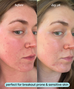 travel-size calming magnesium mist